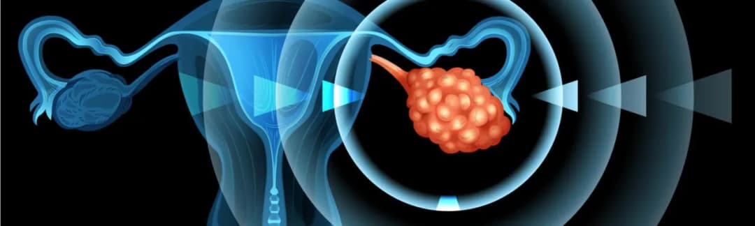 Rak jajnika jakie badania: kluczowe testy, które mogą uratować życie