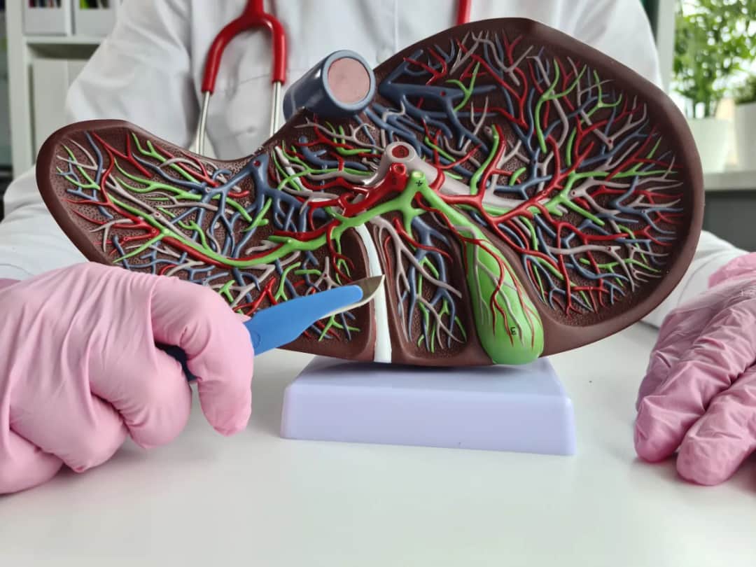 Jakie badania krwi przy kamicy żółciowej? Kluczowe informacje i znaczenie