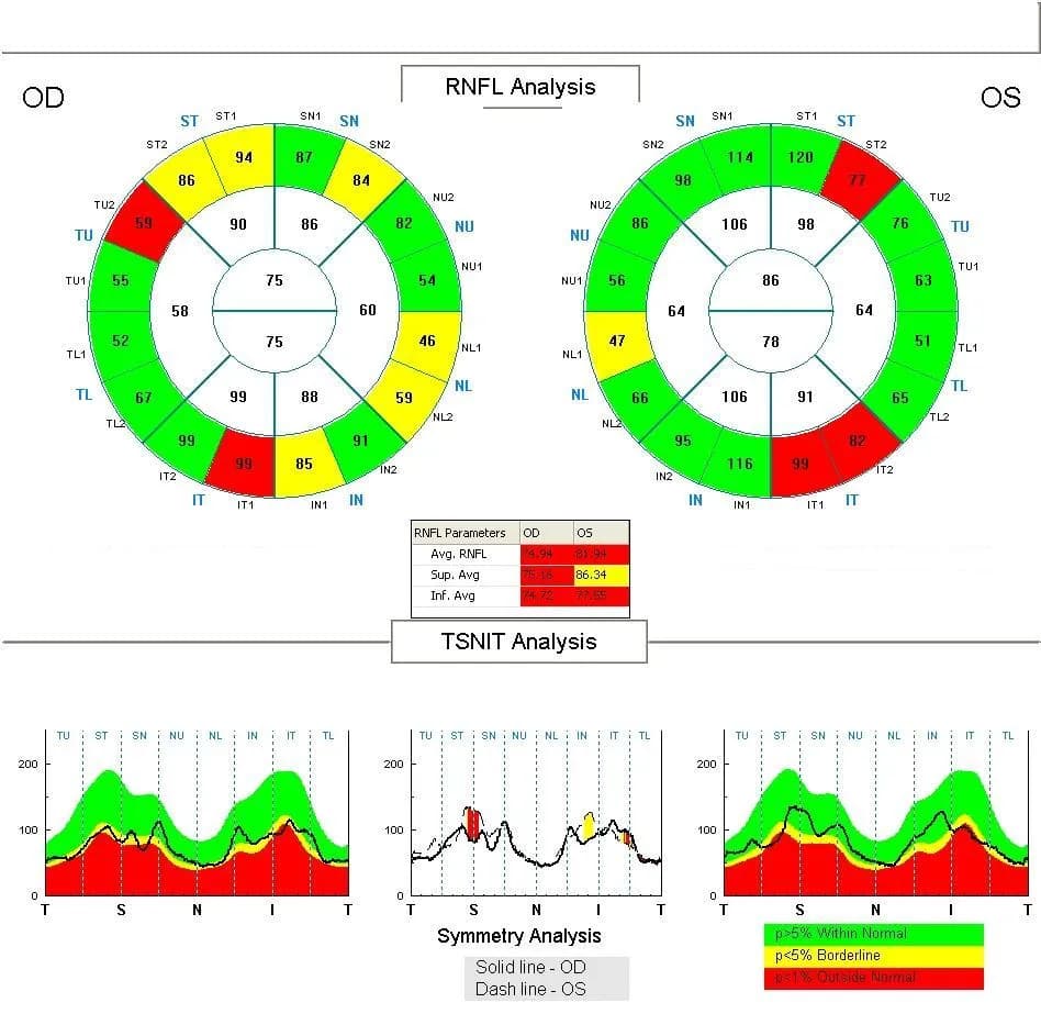 Jak odczytać wyniki badania OCT: proste wskazówki i porady