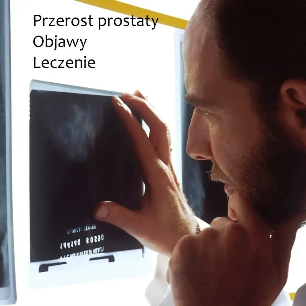 Jak leczyć przerost prostaty? Skuteczne metody i porady dla pacjentów