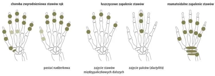 Jakie badania na oddziale reumatologii? Poznaj kluczowe testy diagnostyczne