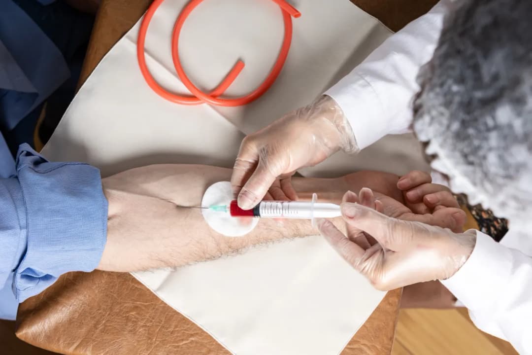 Laboratorium Bruss kiedy wyniki - poznaj czas oczekiwania na badania