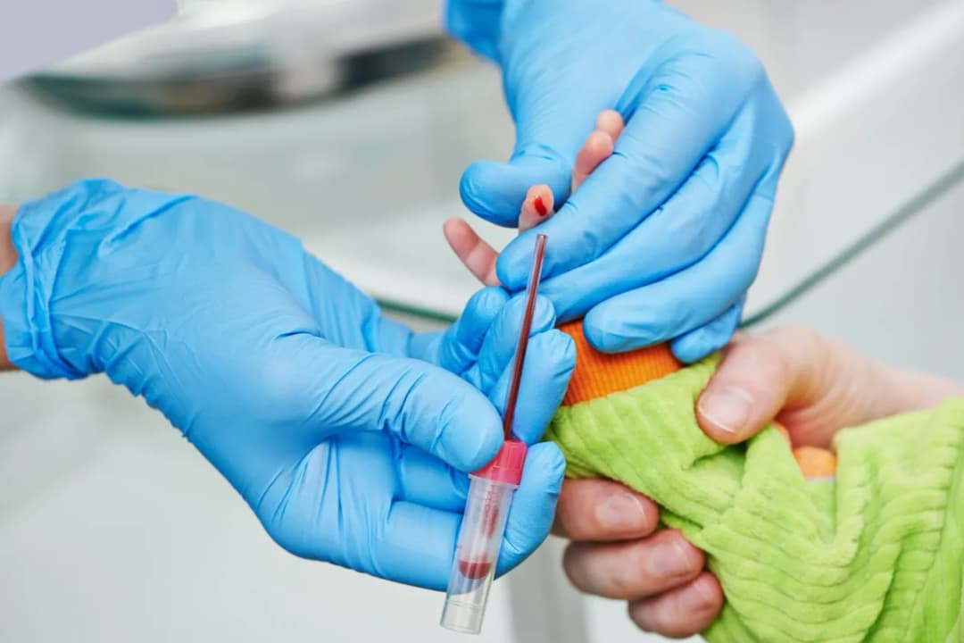 Jak często powinno się robić badanie krwi u dziecka dla zdrowia?