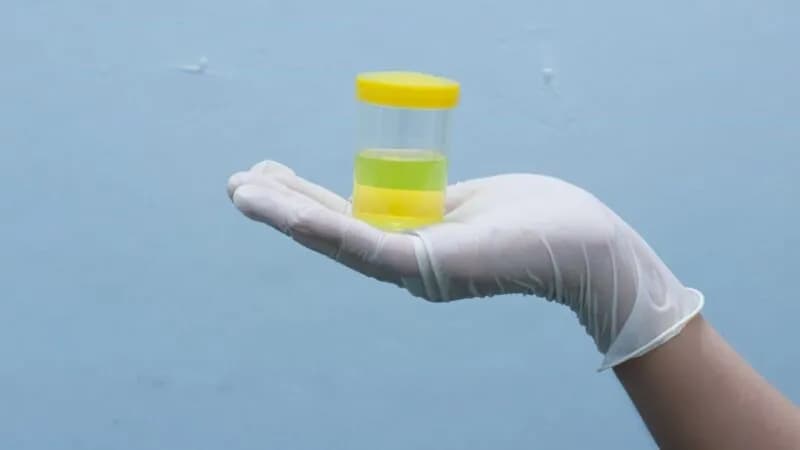 Jak pobrać mocz do badania u 2 latka, aby uniknąć błędów i stresu