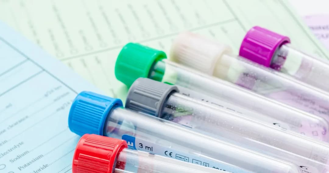 Ile czasu jest ważne skierowanie do laboratorium? Sprawdź, zanim wygaśnie