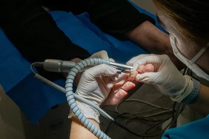 Czy podolog jest na NFZ? Dowiedz się, dlaczego musisz płacić samodzielnie