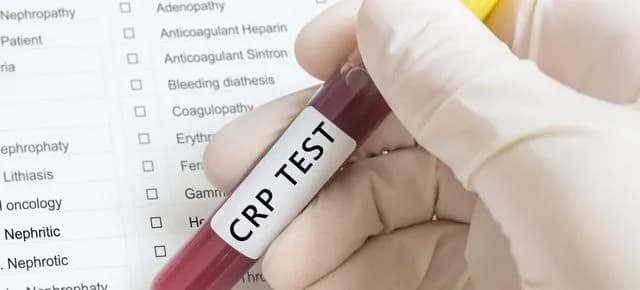 Badania krwi CRP co oznacza? Jak interpretować wyniki i co dalej?