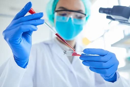 Jakie badania krwi w kierunku udaru mogą uratować życie?