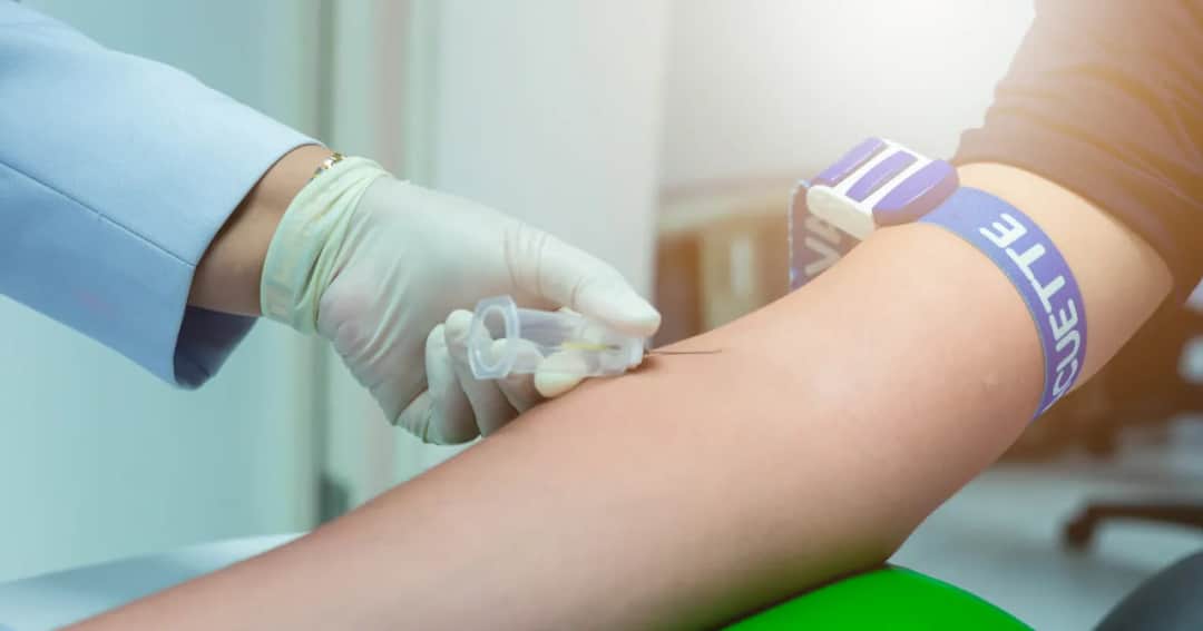 Jakie badania krwi są niezbędne do diagnozy chłoniaka?