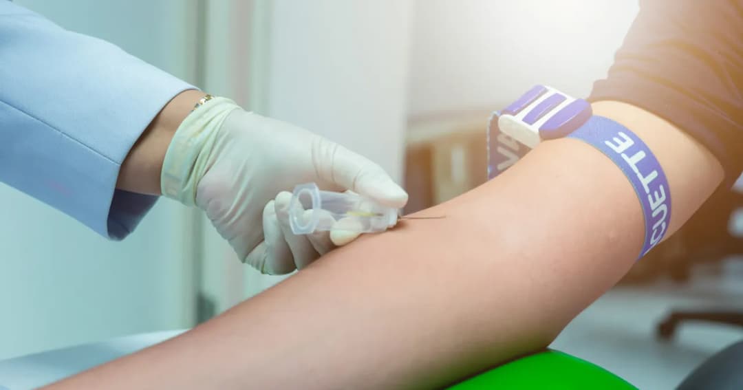 Jakie badania krwi są niezbędne do diagnozy chłoniaka?