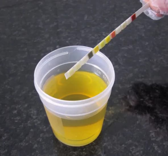 Ile można przechowywać mocz dziecka do badania, aby uniknąć błędów?